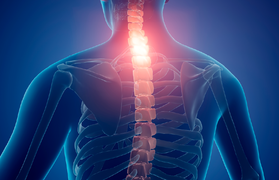 목 / 허리 디스크